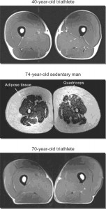 MRI scans of the thigh of a 40-year-old triathlete, a 70-year-old triathlete and a 74-year-old sedentary man. The latter exhibits loss of muscle (grey), which has been replaced extensively by fat (white).